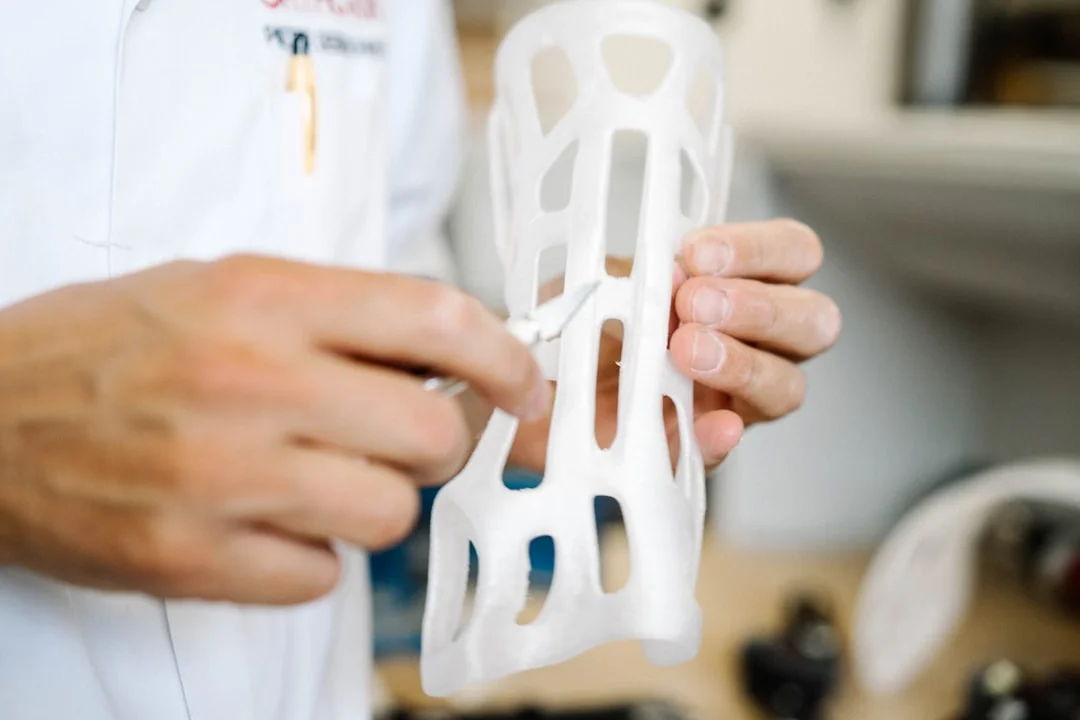 3D printed prosthetic hand engineering